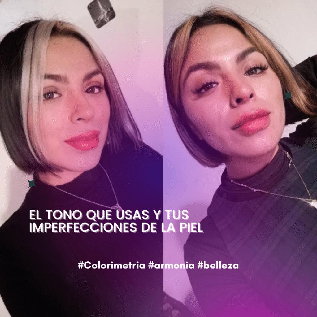 Como mejorar tus manchas de la&nbsp;piel